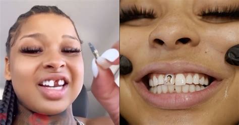 why does chrisean rock have a missing tooth|Bluefaces Artist Chrisean Rock Explains Why She。